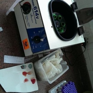 The centrifuge we use along side a broken tile peice used for Typhoid screening and blood 